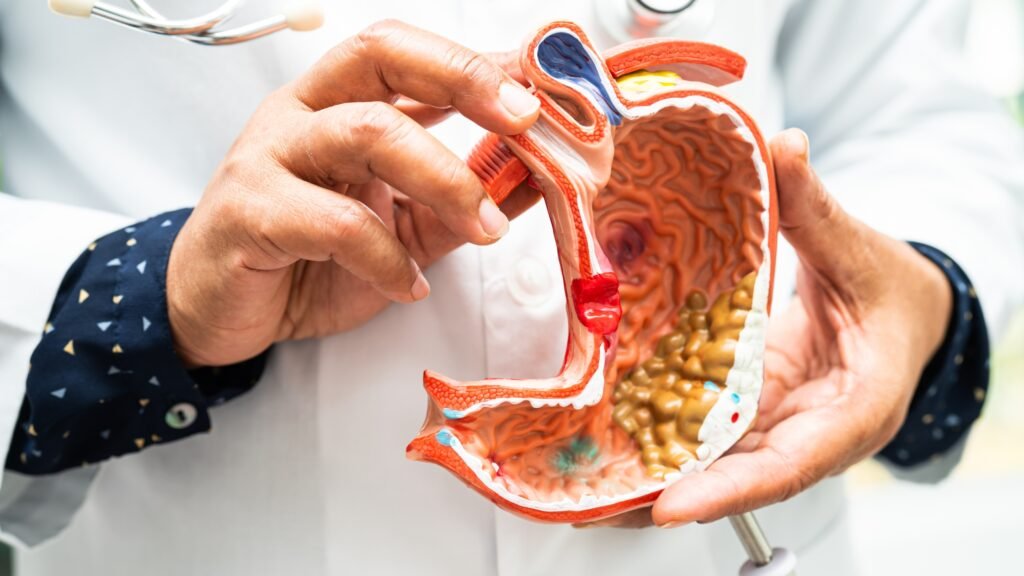 10 Critical Food Poisoning Symptoms You Must Not Ignore! 7 food poisoning symptoms
